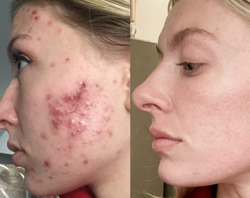 Velora Microcrystal™ Sérum Nuit Duo | Une peau plus lisse en seulement 3 à 5 nuits