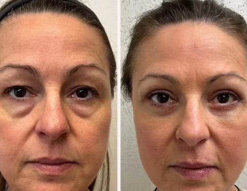 Velora™ | Anti-Wrinkle & Under-Eye Serum. Immediate Effect in 3 Minutes