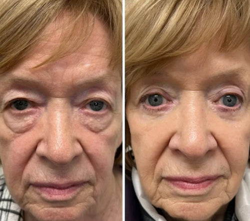 Velora™ | Anti-Falten- und Augenkonturen-Serum