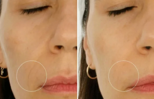 Velora™ | Anti-Falten- und Augenkonturen-Serum
