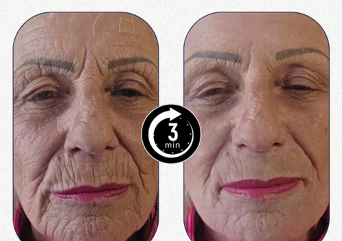 Velora™ | Immediate Effect in 3 Minutes