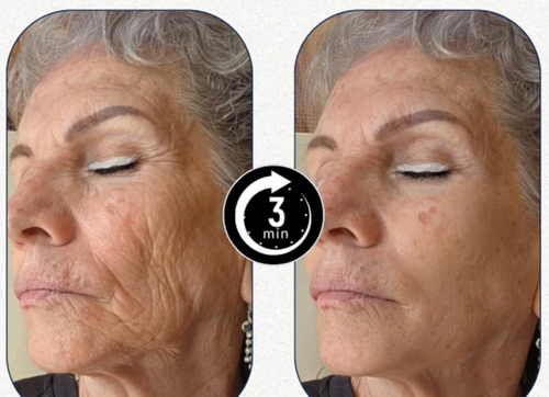 Velora™ | Immediate Effect in 3 Minutes