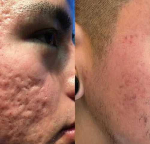 Velora Microcrystal™ Sérum Nuit Duo | Une peau plus lisse en seulement 3 à 5 nuits